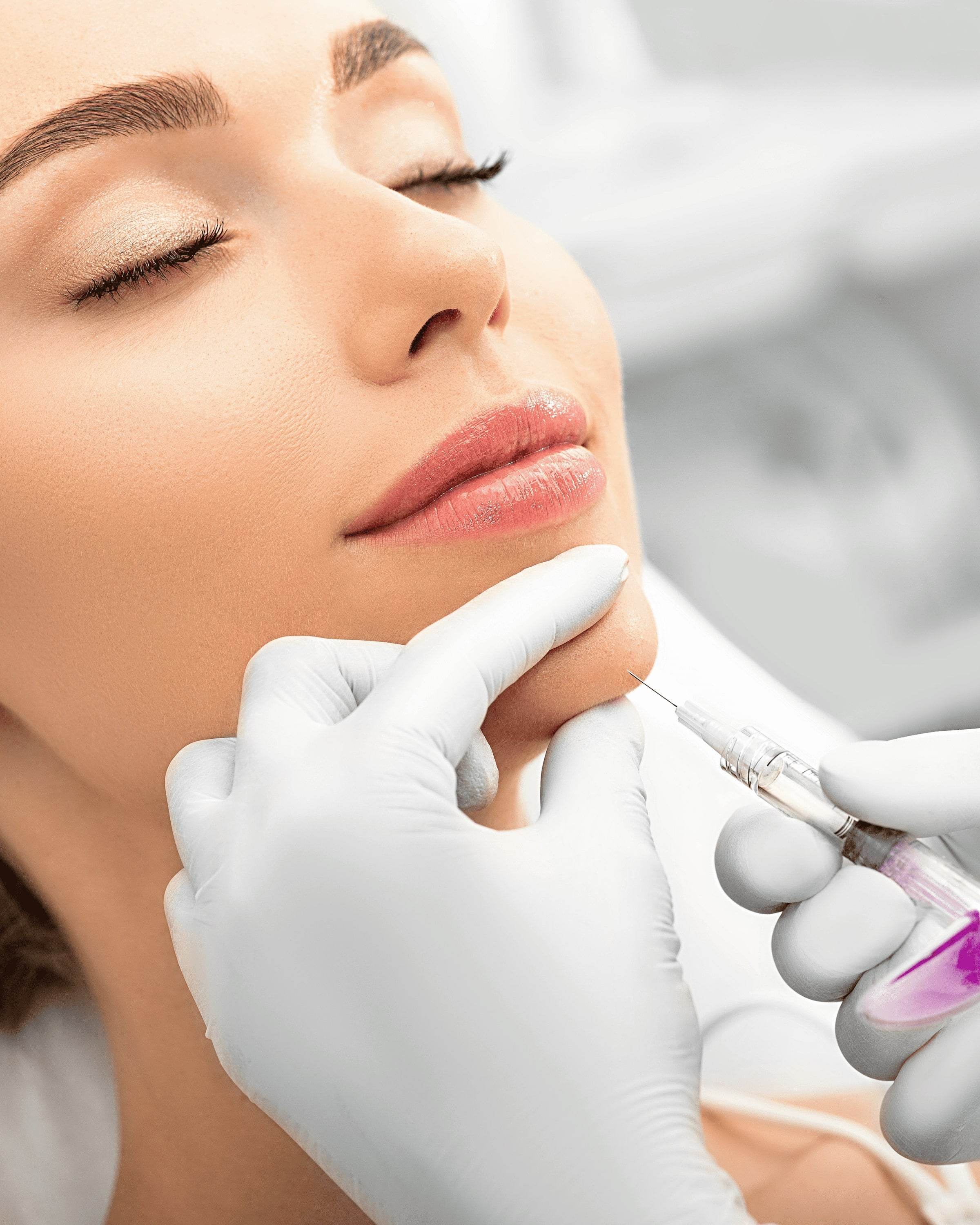 Dermal Fillers - Fillervibe®